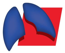 Intergroupe Francophone Cancerologie Thoracique