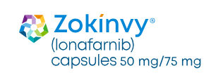 Zokinvy